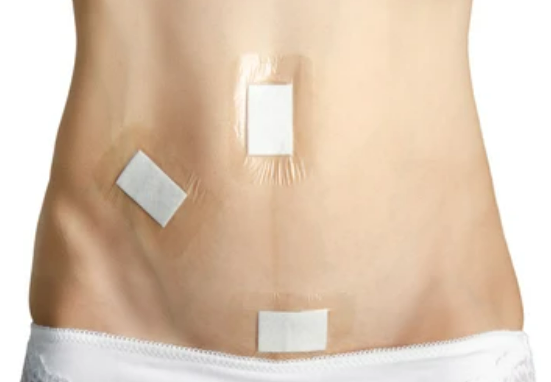 cicatriz das hérnia inguinal