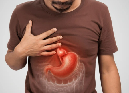 acidez esofagica na hernia de hiato