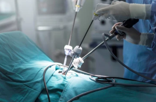 Laparoscopia nas hérnias